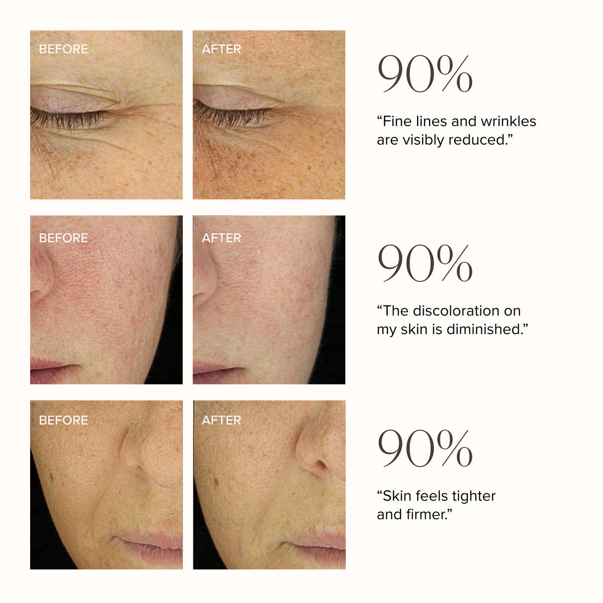 MD Advanced Hydration Crème