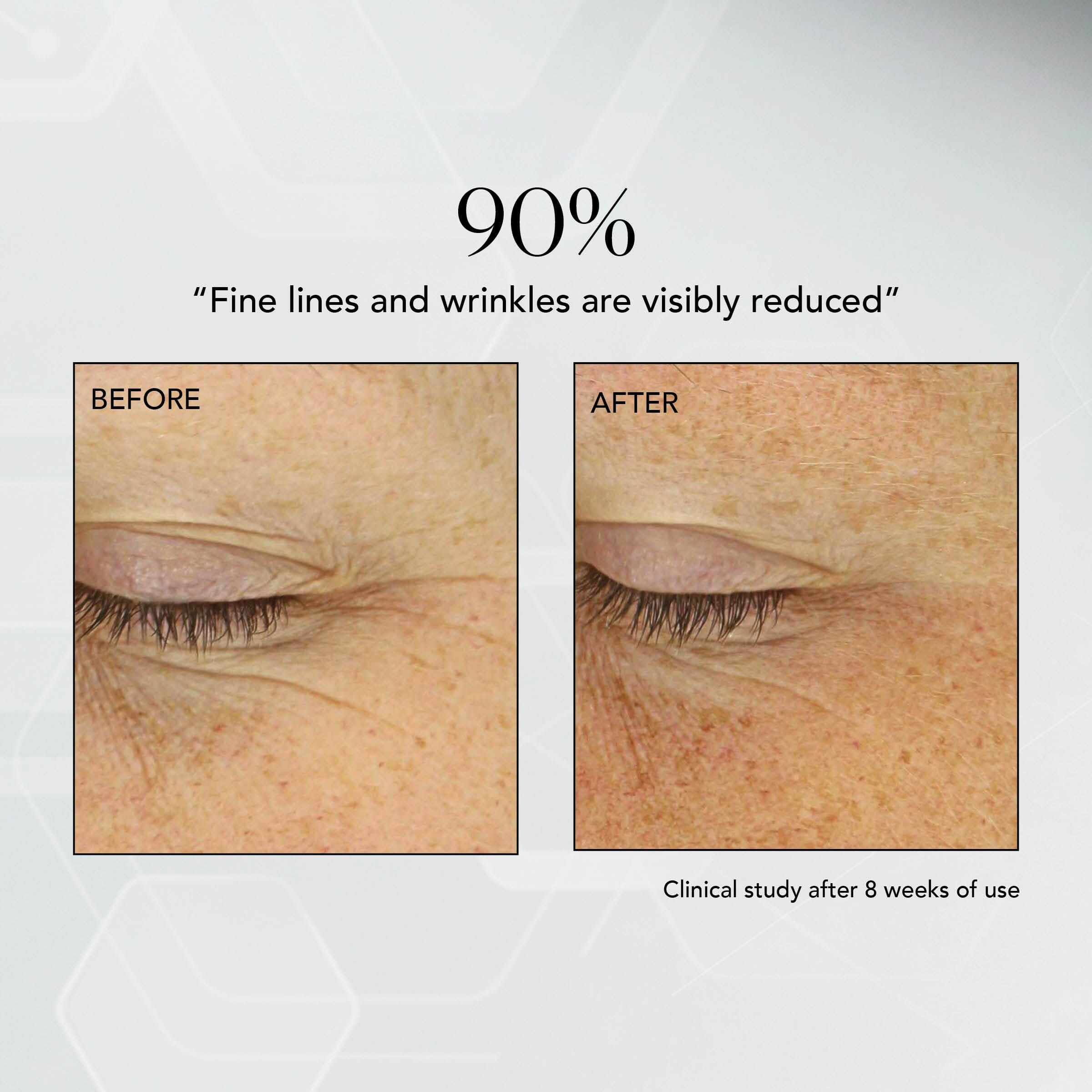 MD Advanced Hydration Crème: Hydrating Night Cream – MDSolarSciences™